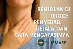 Benjolan di Tiroid: Penyebab, Gejala, dan Cara Mengatasinya